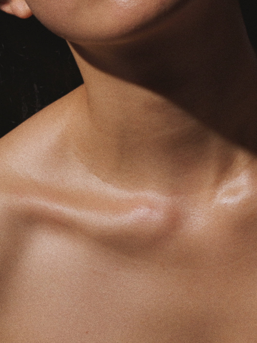 Sans Homepage Ethos Block - Activator Collarbones